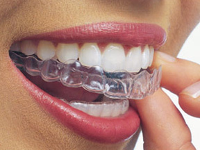 Удаление зубов